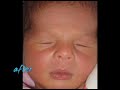 3D 4D Ultrasound Makati - In My Womb
