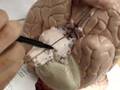 Humananatomy361 Cranial nerves