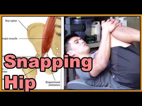 how to cure snapping hip