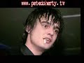Analysis of Pete Doherty\