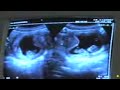 Primeiro ultra-som do beb�