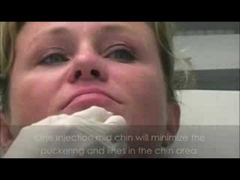See video
