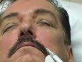 Restylane Injection Cherry Hill Laser &Skin Care Center