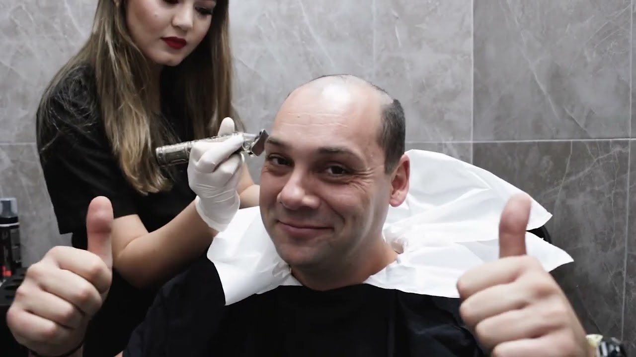 Hair Transplant Patient 10 Days After