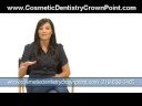 Munster|Indiana|Dental Veneers Munster|Indiana|Dental Veneers