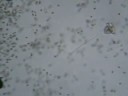 Un �trange micro-organisme dans la mare de mon jardin X 10