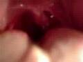 Water-Swallowing