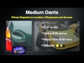 How Does Dent Repair Cost in Cincinnati, Dayton Ohio | Paintless Dent Removal