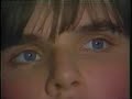 See Saw Nystagmus