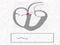 Normal ECG