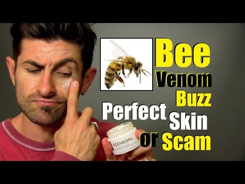 how to treat bee stings nz