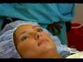 Another anesthesia induction
