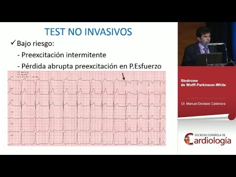 ¿Cuándo derivar a un paciente a la unidad de arritmias? ¿Cuándo derivar a un paciente a la unidad de arritmias?