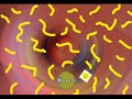 Balls season 1 episode 1