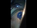 Click here to watch this video Beyblade l drago