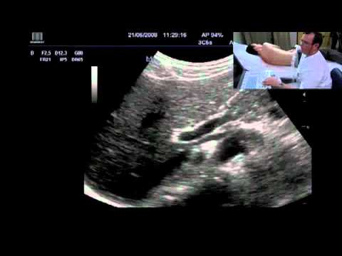 how to read ultrasound