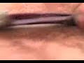 Autopcia de serpiente