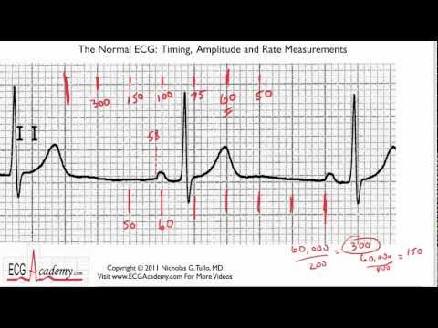 how to determine heart rate