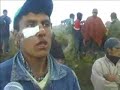 Herido en el ojo 150K Herido en el ojo 150K