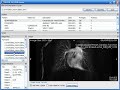 DeVIDE 8.5 DICOM Browser