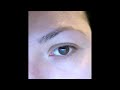 See Video