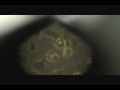 Ciliated Frog Lung Cells
