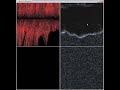 Particle flow warping - vector field interpolation Particle flow warping - vector field interpolation