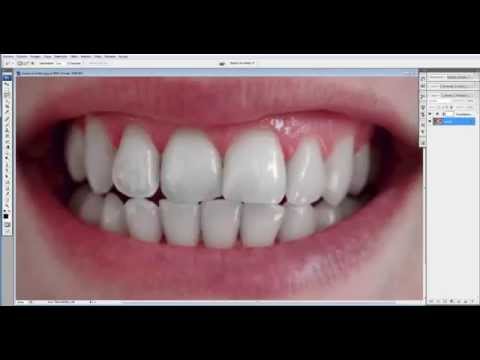 how to whiten teeth in photoshop cs3
