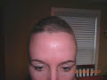 Hair Growth Show Starting 6 Weeks After Chemo