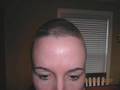 Hair Growth Show Starting 6 Weeks After Chemo