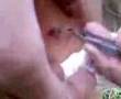 stif shot in leg