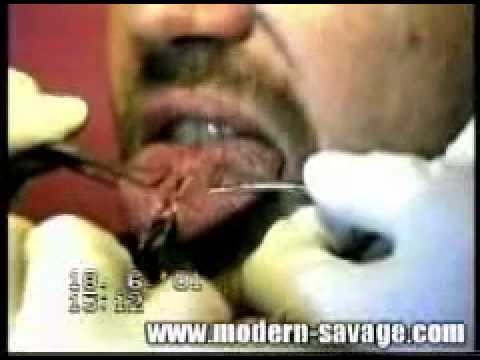 Modern Savage Tatto Studio - Tongue Split 1