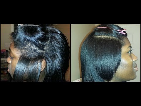 how to treat ethnic hair breakage