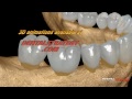Teeth on the lower jaw