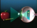 Washington DC Laser Vision Correction & Nearsightedness