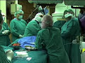 ANEURIZMA ABDOMENALNE AORTE