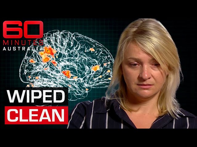 The common virus that can wipe away your memories