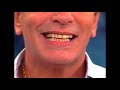 WAGNER MONTES E O DENTE VOADOR