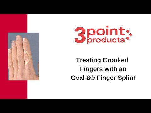 how to treat broken finger