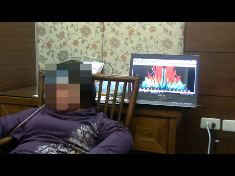 Youtube Epilepsy attack with 3D EEG 1