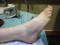 ODE TO MY TOES