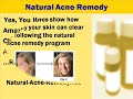 Natural Acne Remedy