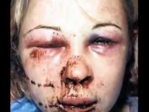 Battering Women