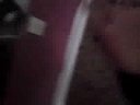 Near Death By Dart