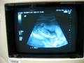 Baby's 16-week Ultrasound