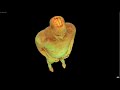 人間の体内の断面図をCGで再現のサムネイル3