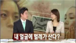모낭충(피부염증,탈모유발)