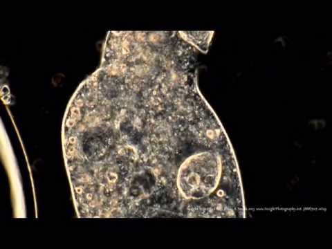 Ciliated Protozoa Heals From Catastrophic Cell Membrane Failure! Darkfield Phase Contrast Combo