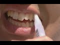 YOTUEL WHITENING STICK & PEN (RUSSIAN)