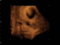 videos de Mi Hija Paula Ponce de León